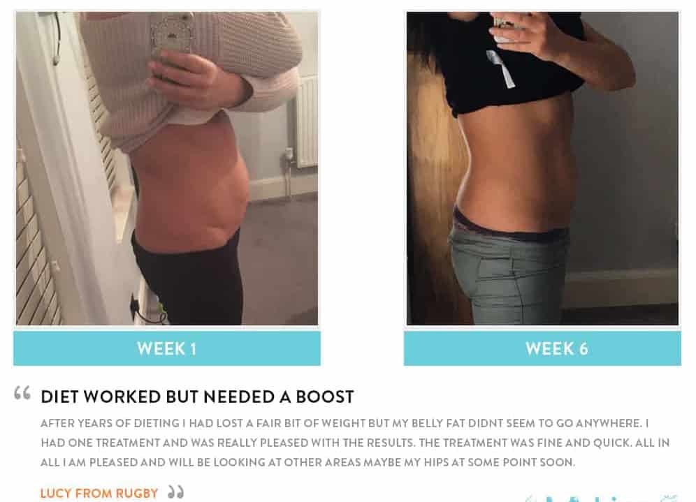 Before and After Dieting Sunbury