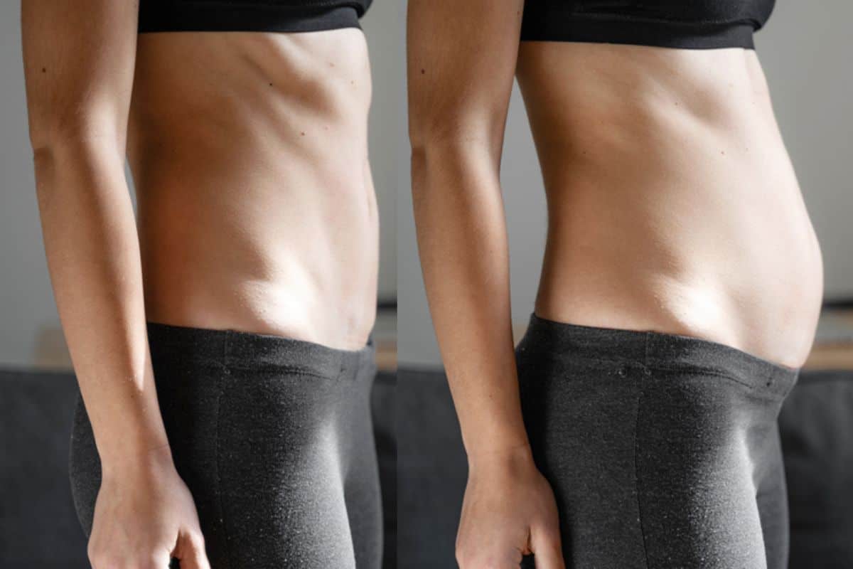 How long does diastasis recti take to improve Sunbury?