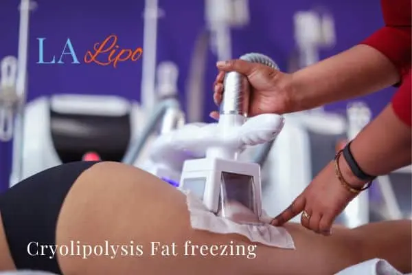 women getting fat freezing Sunbury
