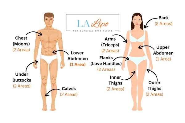 LA LIPO Cryolipolysis Areas Sunbury