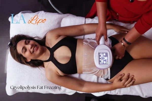 woman getting cryolipolysis Sunbury