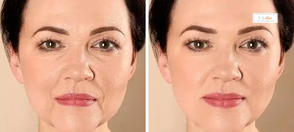How Long Does It Take to See Results and How Long Do They Last Sunbury?