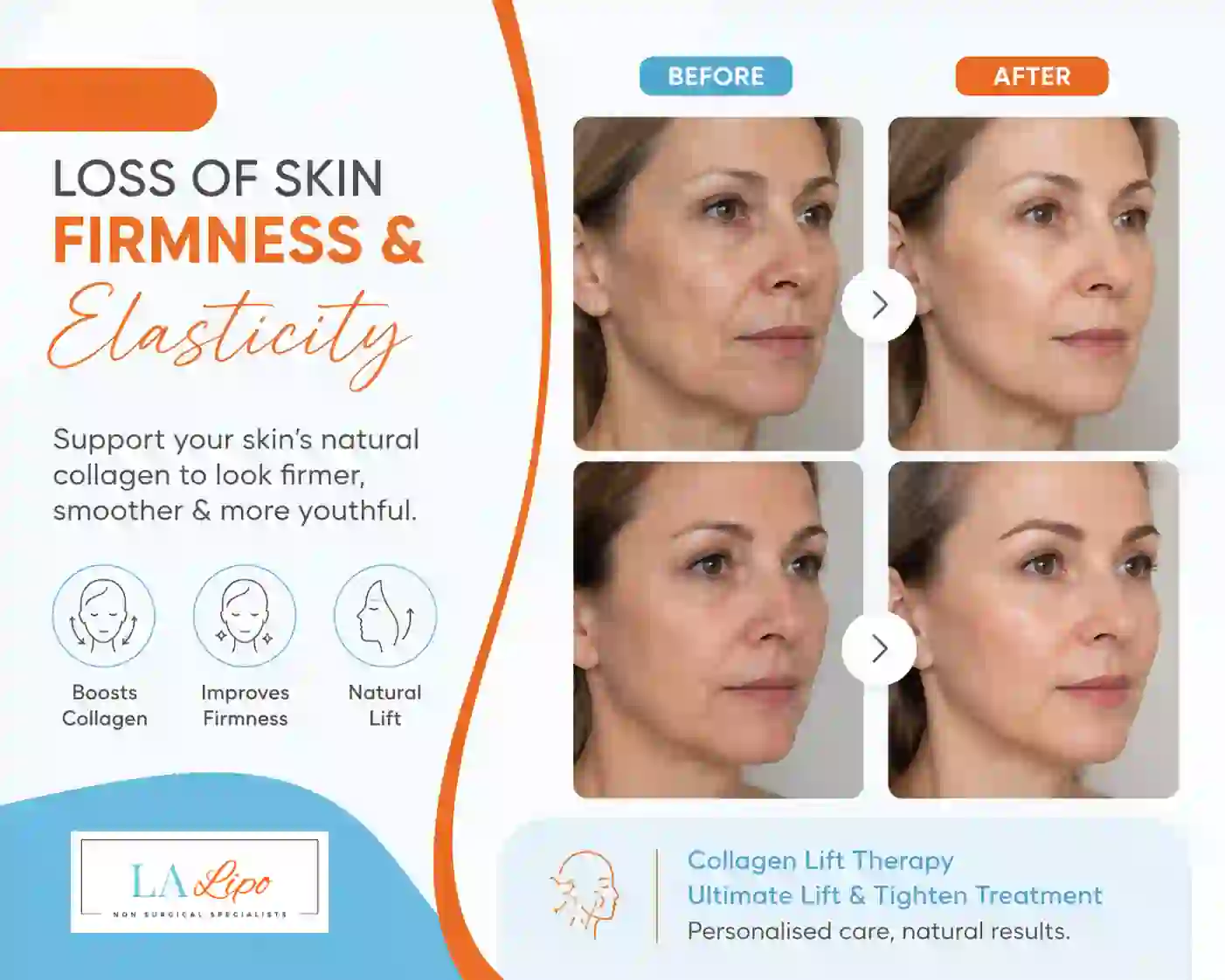 Sign #7: Loss of Skin Firmness and Elasticity Sunbury